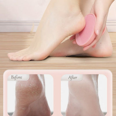 2PCS Foot File Callus Remover Pedicure Tool Heel Dead Skin Scraper Smooth Feet Exfoliator